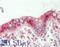 L-36 lactose-binding protein antibody, LS-B11924, Lifespan Biosciences, Immunohistochemistry paraffin image 