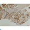 Endothelin Receptor Type B antibody, LS-C813625, Lifespan Biosciences, Immunohistochemistry paraffin image 