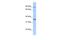 Zinc finger protein 64 homolog, isoforms 1 and 2 antibody, PA5-40664, Invitrogen Antibodies, Western Blot image 