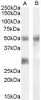 Insulin Like Growth Factor Binding Protein 3 antibody, TA303275, Origene, Western Blot image 