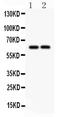 Solute Carrier Family 22 Member 2 antibody, PA5-80015, Invitrogen Antibodies, Western Blot image 