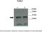 FOS Like 2, AP-1 Transcription Factor Subunit antibody, TA329234, Origene, Western Blot image 