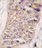 Phosphatidylinositol-4-Phosphate 3-Kinase Catalytic Subunit Type 2 Beta antibody, abx033816, Abbexa, Immunohistochemistry paraffin image 