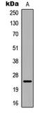 Crystallin Alpha B antibody, LS-C358953, Lifespan Biosciences, Western Blot image 