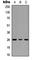 Troponin I3, Cardiac Type antibody, abx121790, Abbexa, Western Blot image 