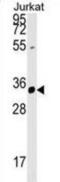 Zinc Finger FYVE-Type Containing 27 antibody, abx029307, Abbexa, Western Blot image 