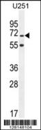 TNFAIP3 Interacting Protein 1 antibody, 55-570, ProSci, Western Blot image 