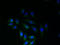 Solute Carrier Family 6 Member 16 antibody, A61022-100, Epigentek, Immunofluorescence image 