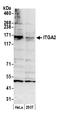 Integrin Subunit Alpha 2 antibody, A305-211A, Bethyl Labs, Western Blot image 