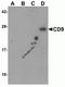CD9 Molecule antibody, A01202, Boster Biological Technology, Western Blot image 