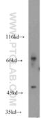 Cerebral Endothelial Cell Adhesion Molecule antibody, 16411-1-AP, Proteintech Group, Western Blot image 