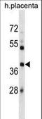 Siah E3 Ubiquitin Protein Ligase 1 antibody, LS-C161084, Lifespan Biosciences, Western Blot image 