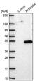 Family With Sequence Similarity 185 Member A antibody, NBP1-93478, Novus Biologicals, Western Blot image 