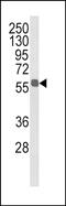 Aldehyde Dehydrogenase 3 Family Member B1 antibody, PA5-49628, Invitrogen Antibodies, Western Blot image 