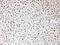 High Mobility Group Box 1 antibody, A00066-1, Boster Biological Technology, Immunohistochemistry paraffin image 