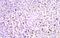 Prothymosin Alpha antibody, 10480-1-AP, Proteintech Group, Immunohistochemistry frozen image 