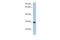 Crystallin Beta A1 antibody, A05880, Boster Biological Technology, Western Blot image 