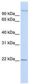 PDS5 Cohesin Associated Factor B antibody, TA344381, Origene, Western Blot image 