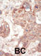 CD135 antibody, abx033569, Abbexa, Immunohistochemistry paraffin image 