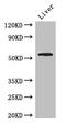 Solute Carrier Family 18 Member A1 antibody, CSB-PA021426LA01HU, Cusabio, Western Blot image 