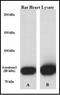 Aconitase 2 antibody, orb88925, Biorbyt, Western Blot image 