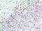 Cyclin Dependent Kinase Inhibitor 1C antibody, A01244, Boster Biological Technology, Immunohistochemistry paraffin image 