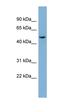 Tubulin Epsilon 1 antibody, orb326127, Biorbyt, Western Blot image 