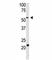 Beta-Secretase 2 antibody, F49441-0.4ML, NSJ Bioreagents, Western Blot image 