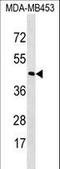 Rhodopsin antibody, LS-C162591, Lifespan Biosciences, Western Blot image 