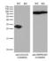 Galectin 3 antibody, LS-C790336, Lifespan Biosciences, Western Blot image 