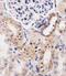 Adenosine Kinase antibody, M02193-1, Boster Biological Technology, Immunohistochemistry paraffin image 