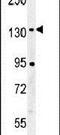 Cartilage Intermediate Layer Protein 2 antibody, PA5-25800, Invitrogen Antibodies, Western Blot image 