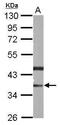 Phytanoyl-CoA 2-Hydroxylase Interacting Protein antibody, PA5-31835, Invitrogen Antibodies, Western Blot image 