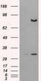 Dipeptidyl Peptidase 4 antibody, GTX84602, GeneTex, Western Blot image 