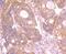 Insulin Receptor Related Receptor antibody, A08212-1, Boster Biological Technology, Immunohistochemistry paraffin image 