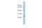 Doublesex And Mab-3 Related Transcription Factor 3 antibody, A08178, Boster Biological Technology, Western Blot image 