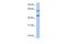 Netrin 4 antibody, PA5-43391, Invitrogen Antibodies, Western Blot image 