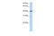 Nuclear Receptor Subfamily 1 Group H Member 3 antibody, 25-443, ProSci, Western Blot image 