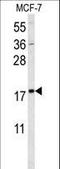 Small Ubiquitin Like Modifier 1 antibody, LS-C161612, Lifespan Biosciences, Western Blot image 