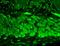 Potassium Sodium-Activated Channel Subfamily T Member 2 antibody, NBP1-47606, Novus Biologicals, Immunohistochemistry paraffin image 