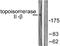 DNA Topoisomerase II Beta antibody, A02750, Boster Biological Technology, Western Blot image 