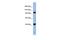 Argonaute RISC Component 4 antibody, PA5-44939, Invitrogen Antibodies, Western Blot image 