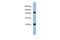 Argonaute RISC Component 4 antibody, PA5-44939, Invitrogen Antibodies, Western Blot image 