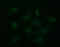 CD36 Molecule antibody, LS-C174758, Lifespan Biosciences, Immunofluorescence image 
