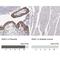 Snail Family Transcriptional Repressor 1 antibody, NBP2-61631, Novus Biologicals, Immunohistochemistry paraffin image 