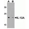 Interleukin-12 subunit alpha antibody, TA349020, Origene, Western Blot image 