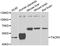 Tachykinin Receptor 3 antibody, orb247861, Biorbyt, Western Blot image 