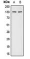 Collagen Type I Alpha 2 Chain antibody, orb213758, Biorbyt, Western Blot image 