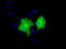 Adenylate Kinase 5 antibody, LS-C115592, Lifespan Biosciences, Immunofluorescence image 