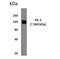 Fms Related Tyrosine Kinase 3 antibody, NBP2-12311, Novus Biologicals, Western Blot image 